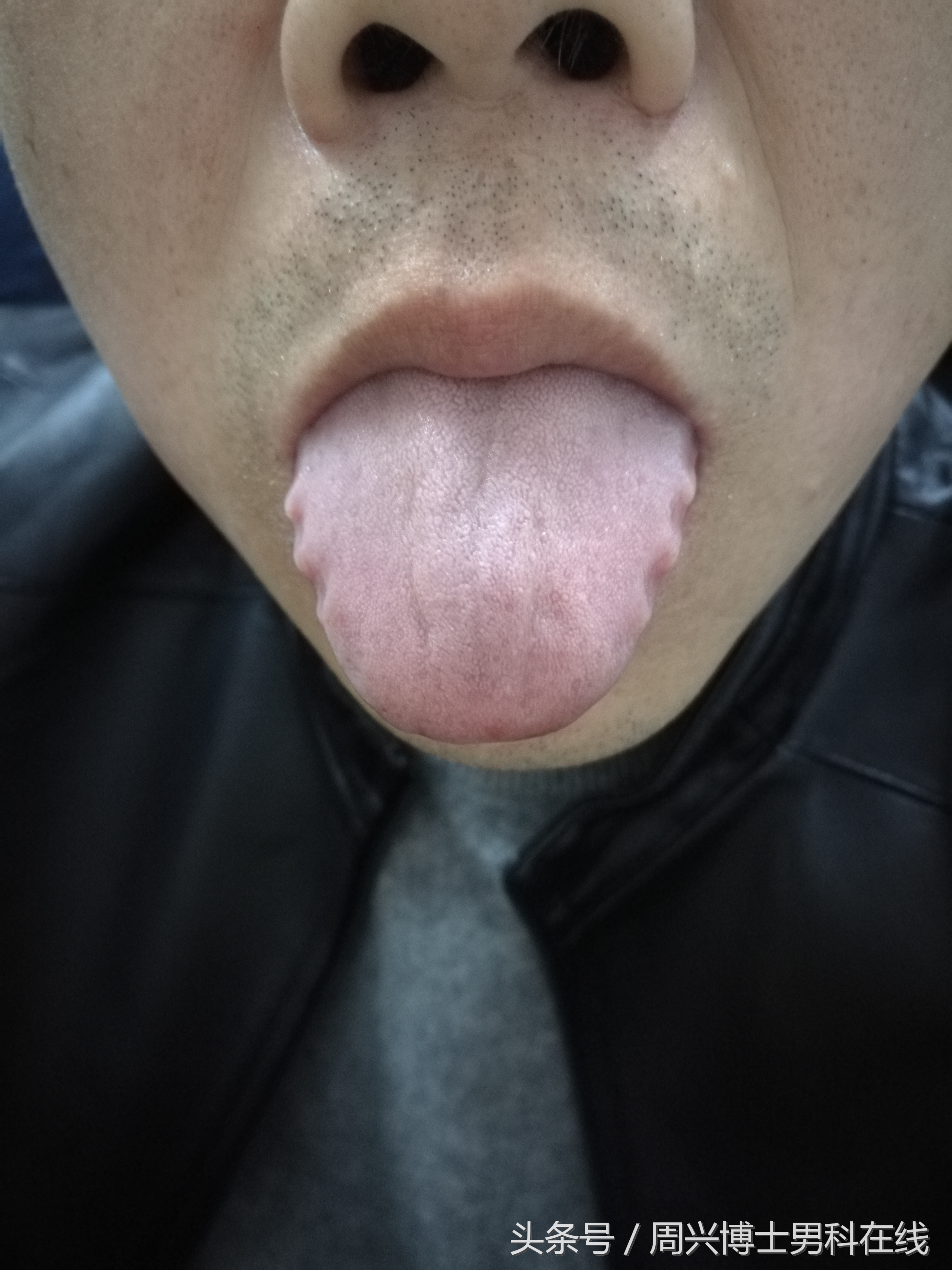 辨清“肾虚”,让大家明明白白“补肾”