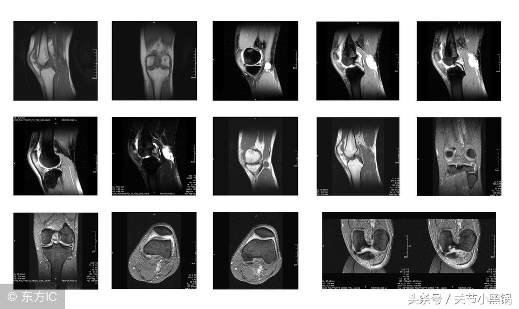 关节炎医生能检查出来吗,关节炎医生需要了解什么