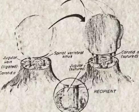 百年残暴治疗史堆砌的事实:同性恋不是病,请放弃治疗