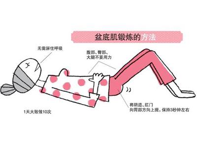 产后子宫壁脱垂,产后子宫脱垂能痊愈吗