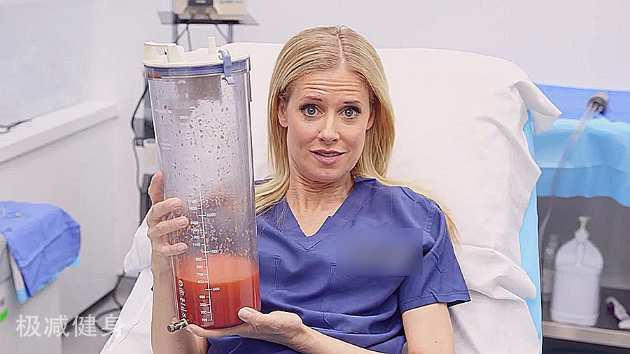 减肥抽脂的过程是怎样的,抽脂减肥的危害亲身经历