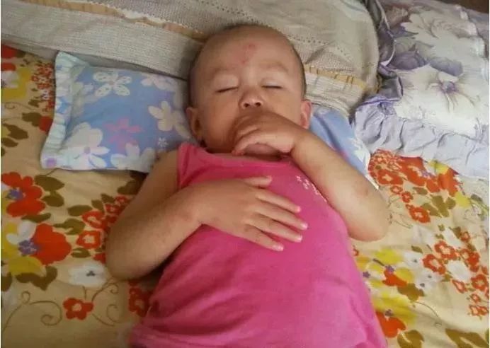 儿童摔到后脑勺几天是危险期,小孩摔到后脑勺什么症状比较危险