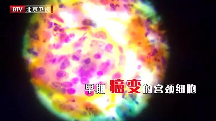 女人腰痛是妇科病引起的吗,女性下腹部隐痛腰痛是不是宫颈癌