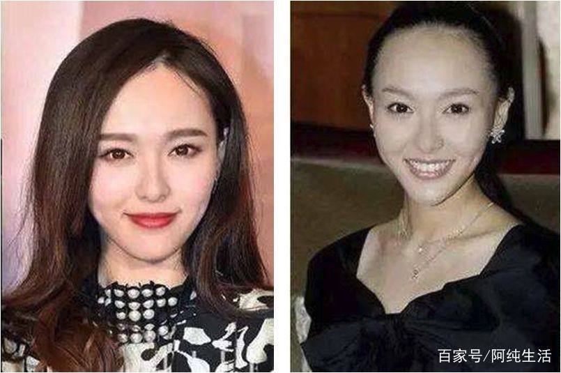 发际线脱发的原因和治疗方法,不要让发际线后移