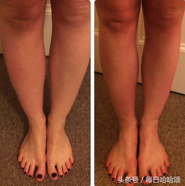 三个动作拯救你的粗腿,拯救粗腿的4个好习惯