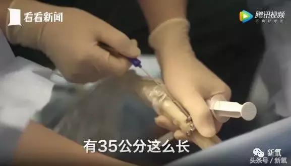 骗女生上床还买卖女生卵子，这些卖卵中介去死吧！