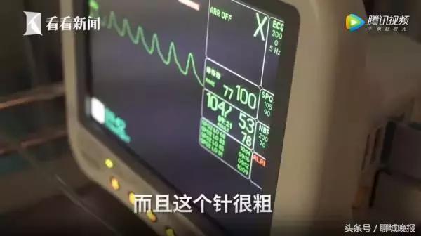 18岁姑娘多次捐卵致生命垂危,女学生捐卵新闻