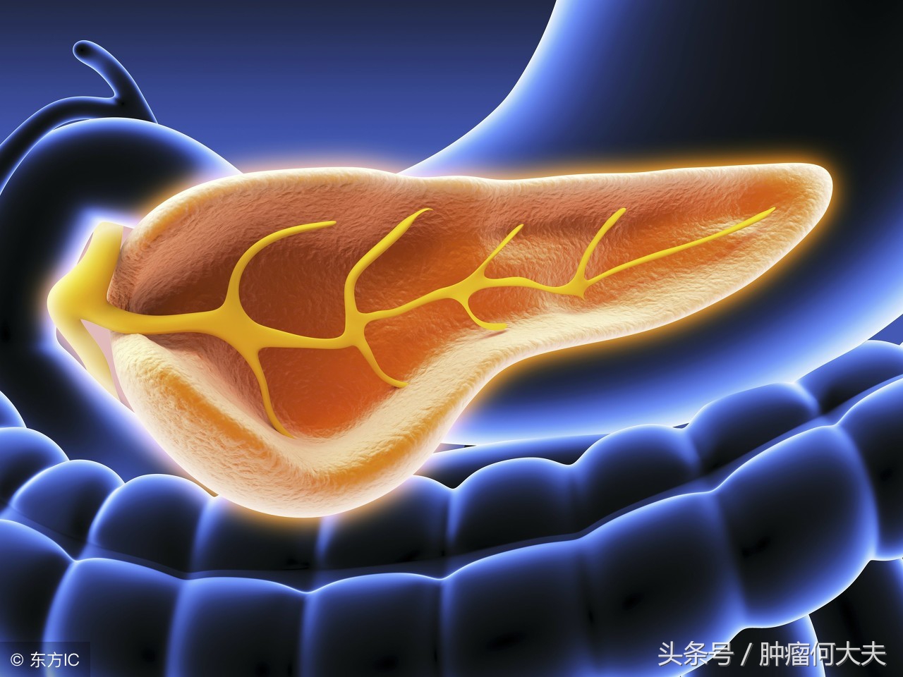 请问胰腺癌早期是什么症状啊,癌中之王胰腺癌怎么筛查