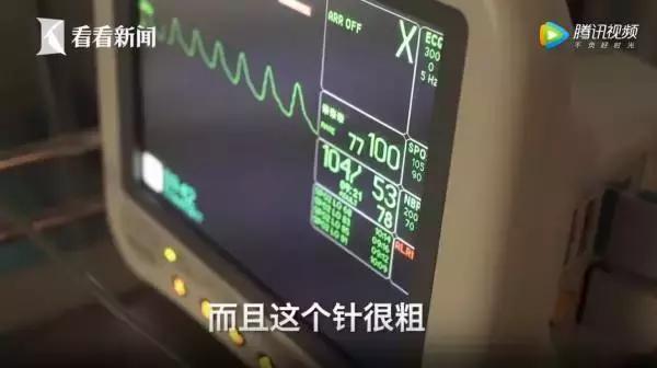 20岁女大学生捐卵,女大学生捐卵案