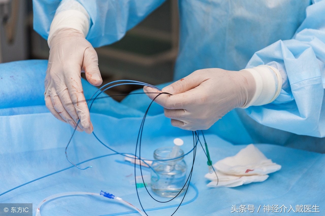 年轻人如何预防和缓解脑血管疾病,如何确诊脑血管疾病