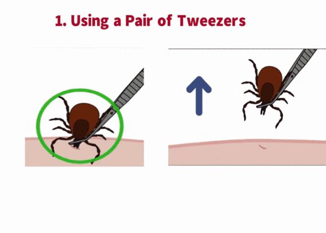 带小孩去草地玩怎么预防蜱虫,带孩子玩小虫子