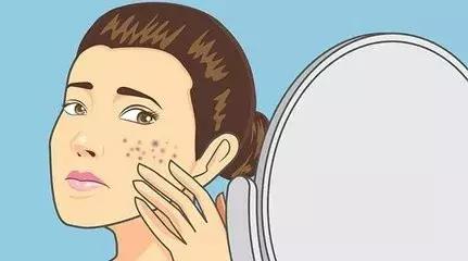 青春期如何祛除痘痘闭口痘印 (如何有效去除闭口和痘痘)