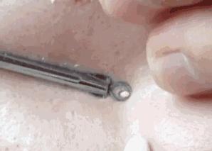 去黑头草莓鼻最有效的方法,怎么去黑头不会变草莓鼻