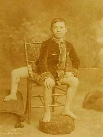 我看了场大尺度畸形人体秀，从此再也没睡过安稳觉！