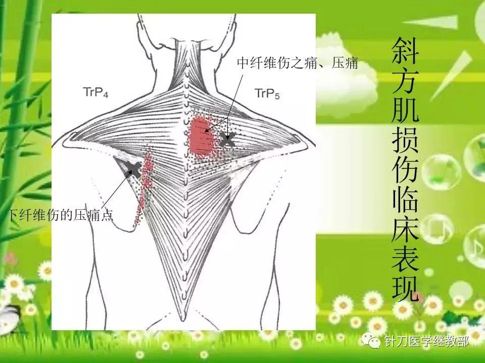 颈椎肌肉损伤用小针刀治疗,针刀治疗颈椎导致神经损伤