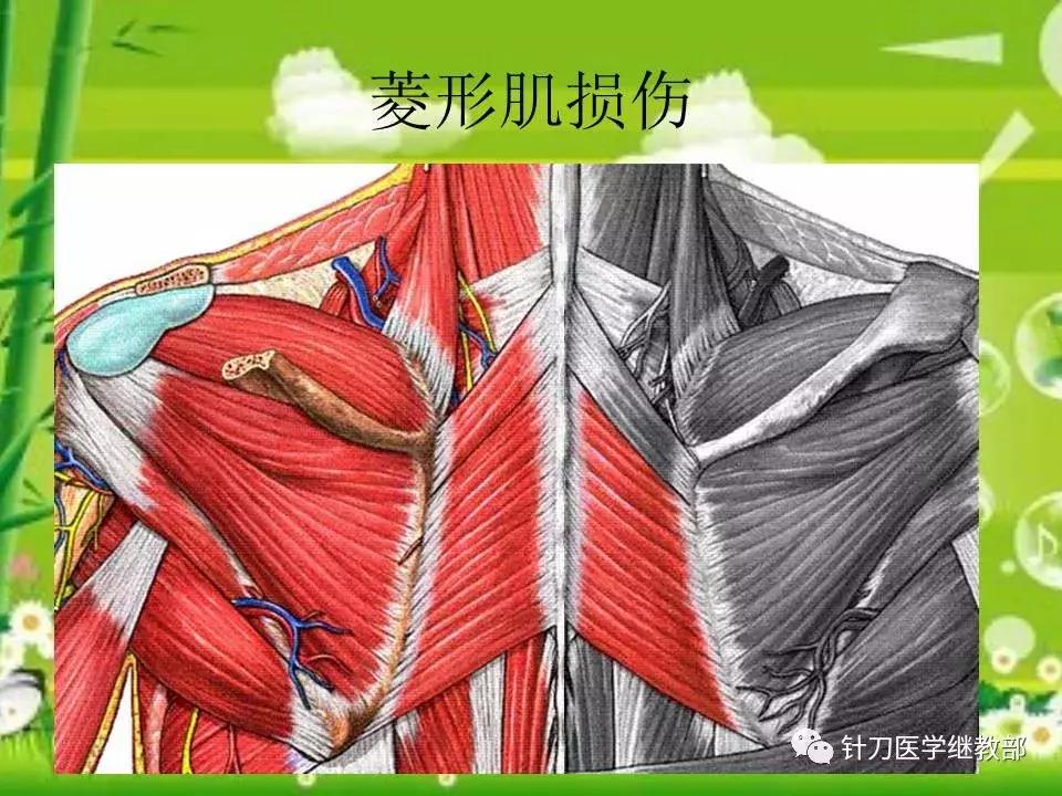 颈椎肌肉损伤用小针刀治疗,针刀治疗颈椎导致神经损伤