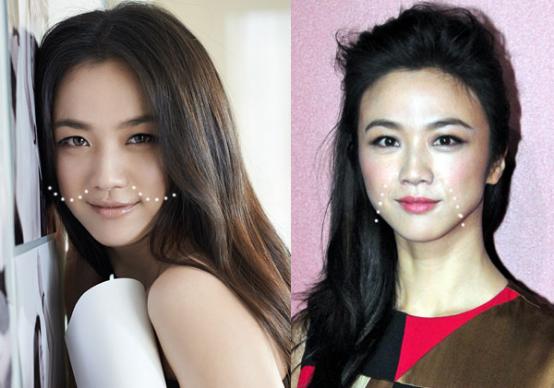 爱笑的女孩法令纹都很深,爱笑的女孩有法令纹怎么办