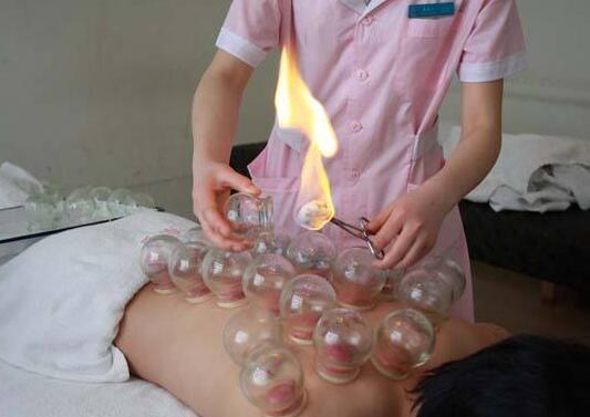 拔火罐减肥的原理及危害有哪些,拔火罐可以祛湿气减肥