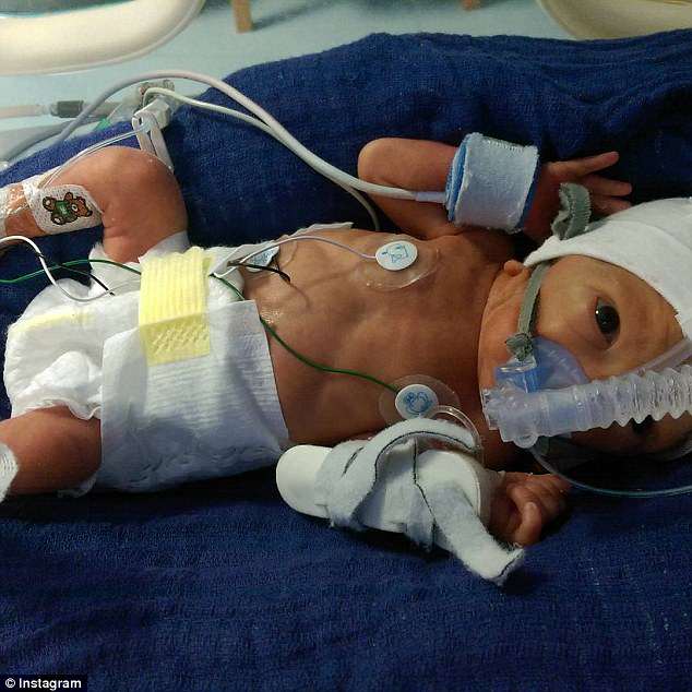 每天喝800mml水能补多少羊水,每天8杯水200毫升