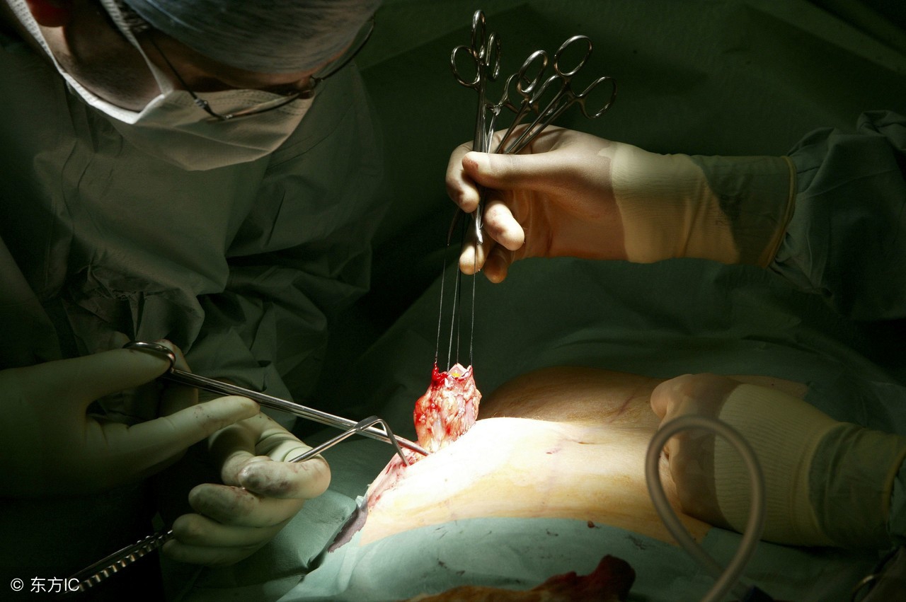 呕血预后,贲门癌呕血有多严重