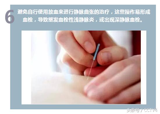 蚯蚓纹是怎么回事呢,大腿根部蚯蚓纹越来越多