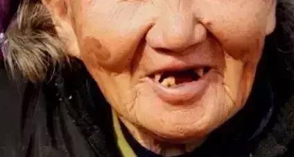 口腔公益片广告,缺失牙公益广告韩国