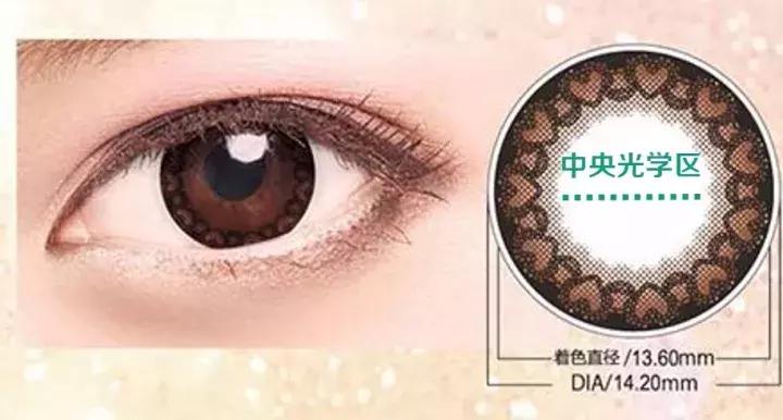 长期佩戴美瞳血管长到黑眼球附近,戴美瞳眼球上长了毛细血管