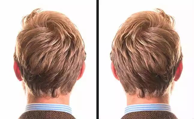 为什么头顶上有发旋,脑袋上有旋是怎么回事