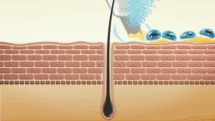 洁面脱毛仪,洁面脱毛仪测评