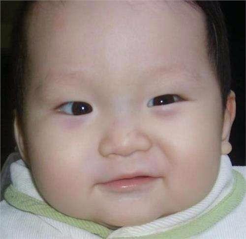 宝宝感冒咳嗽厉害脸上有几个红点,小孩感冒咳嗽脸上起红疹子