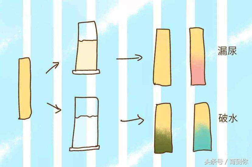 孕晚期老是上厕所，学会这个动作，轻松解决孕期漏尿尴尬！