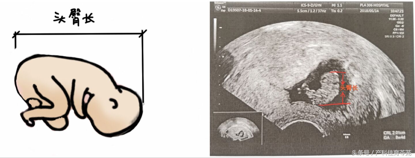 如何看懂乳腺超声检查报告,怎么能让临床医生看懂超声报告
