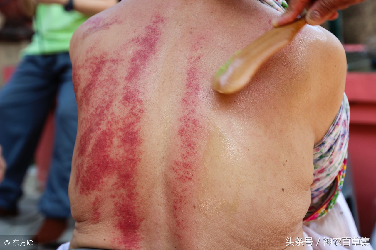 中医全息刮痧的基本刮痧手法,中医刮痧手法与疗法标准