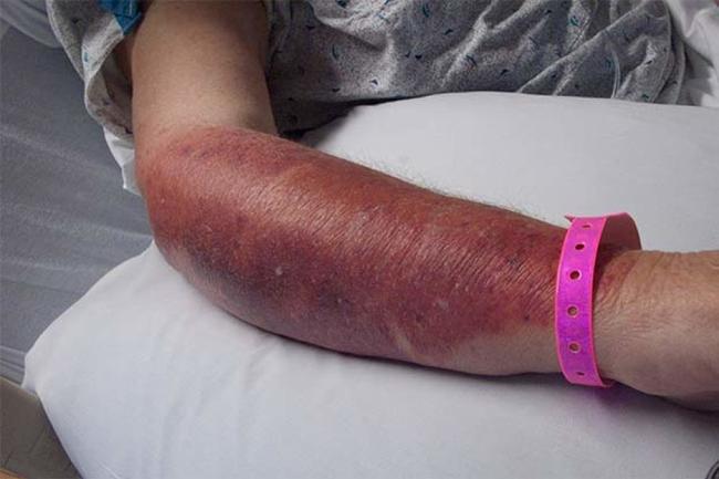 手机上最常见的10种细菌