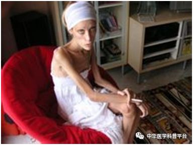 不明原因的消瘦到医院挂什么科室,不明原因的消瘦是瘦多少