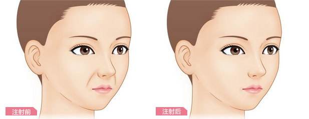 处女脸、果汁脸，你的老公鹿晗林更新们到底心水哪一款？