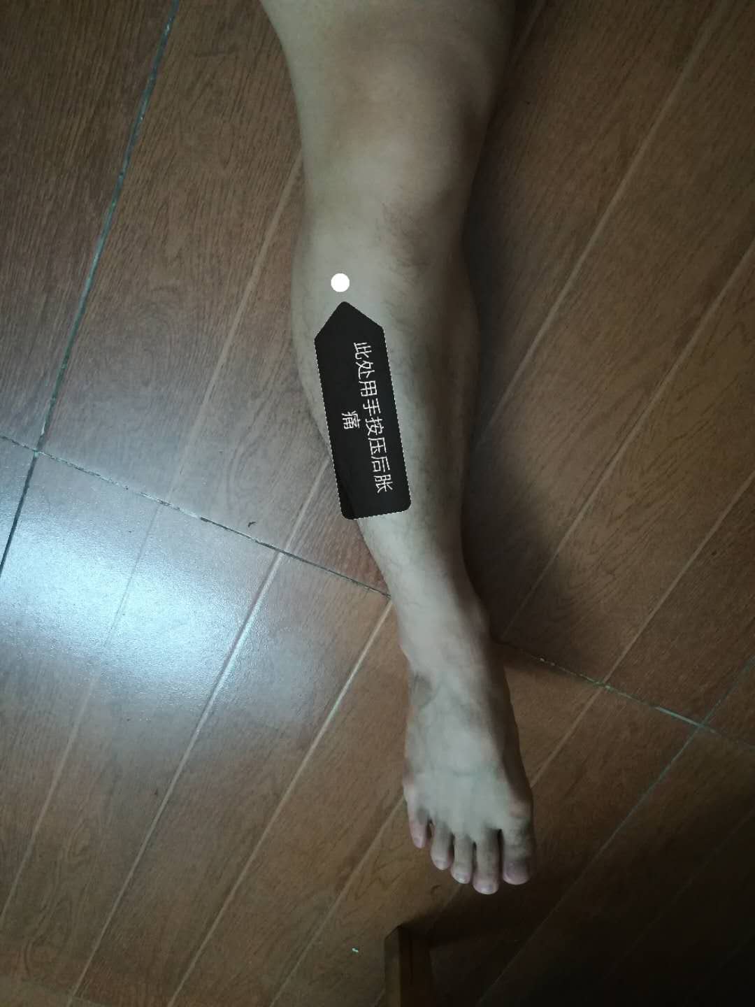 蔡赟答疑-35:增强足底力量根治筋膜炎