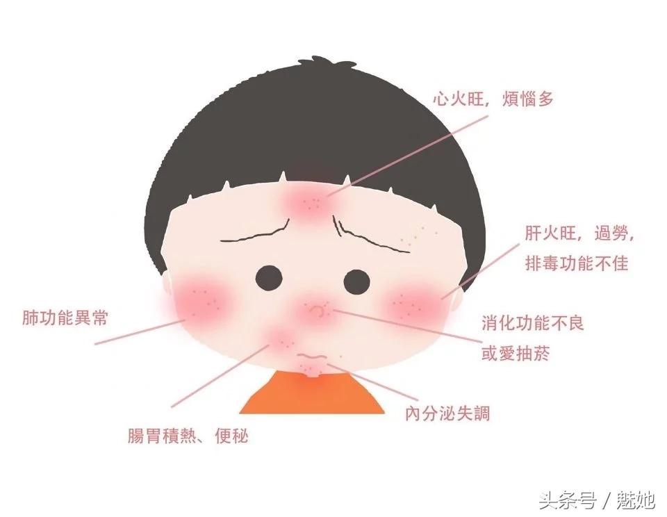 脸上痘印和红痘最佳消灭法,战痘神器工具