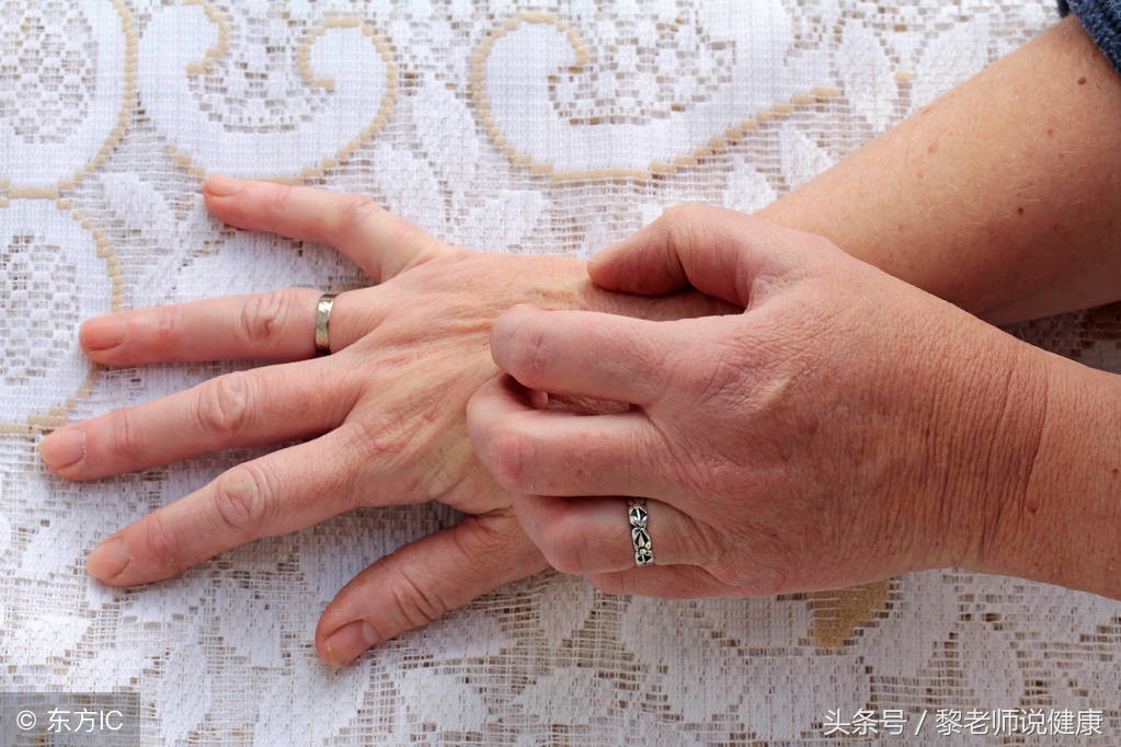 手脚脱皮皲裂用什么药,手脚干裂脱皮痒抹什么药治疗好呀