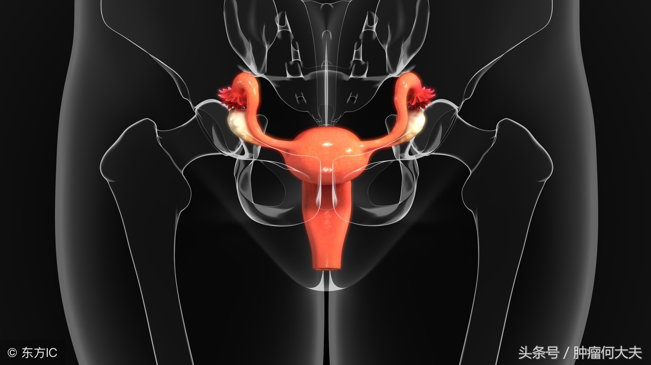 宫颈癌早期可以打宫颈癌疫苗吗,子宫癌和宫颈癌早期会发烧吗