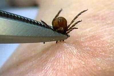 被虫子咬怎么治虫子,如何预防虫咬伤