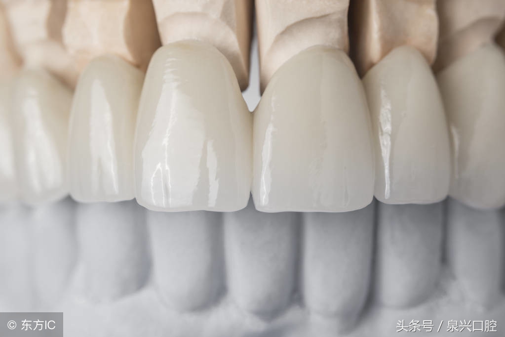 全烤瓷牙有什么风险和后遗症,烤瓷牙都有哪些危害及注意事项