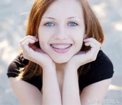 戴自锁牙套饮食注意事项,戴了牙套以后需要怎么护理