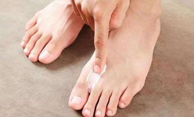 秋冬季节脚气犯了怎么办,脚气夏季怎么办