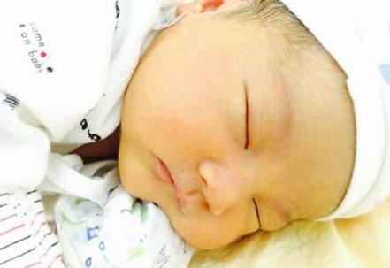 新生儿黄疸退了黄疸值多少,新生儿黄疸一般多少天消退