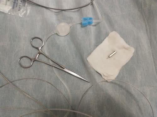 男孩误吞铁钉交警送医,8岁儿童误吞3厘米螺丝