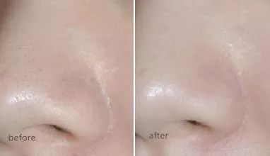 洁面吸油神器,电动洗脸神器清洁毛孔