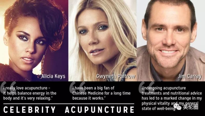哈里梅根婚前求助中医！歪果仁已经把针灸吹上了天
