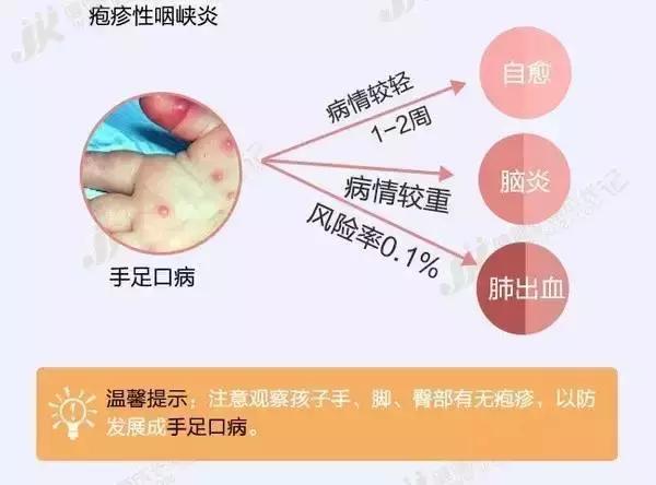小孩发烧嘴里起泡有疹子,小孩发烧流感嘴巴起了好多溃疡
