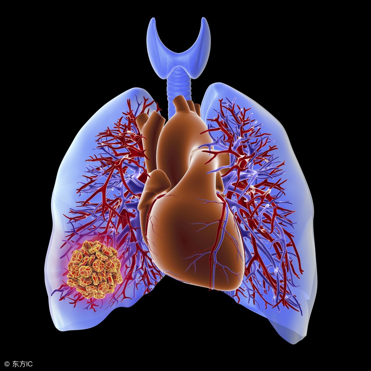 肺栓塞的症状有哪些呢？如何治疗